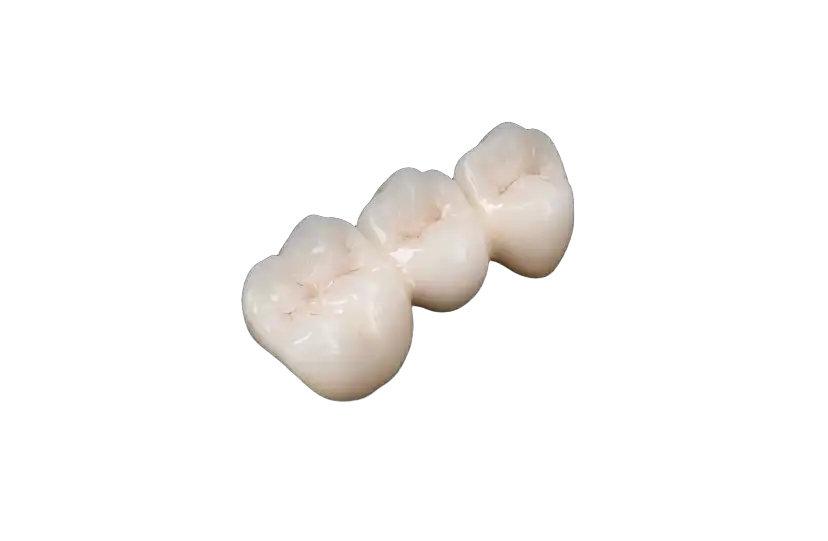 Co-Cr PFM Crowns: Features, Benefits and Applications in Dentistry